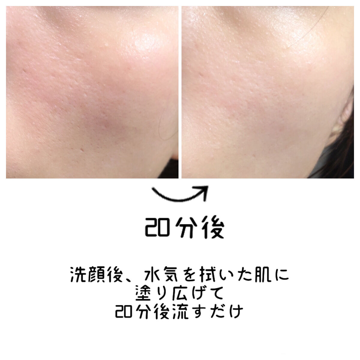 リリーフカモミールマスク/HYGGEE/洗い流すパック・マスクを使ったクチコミ（3枚目）