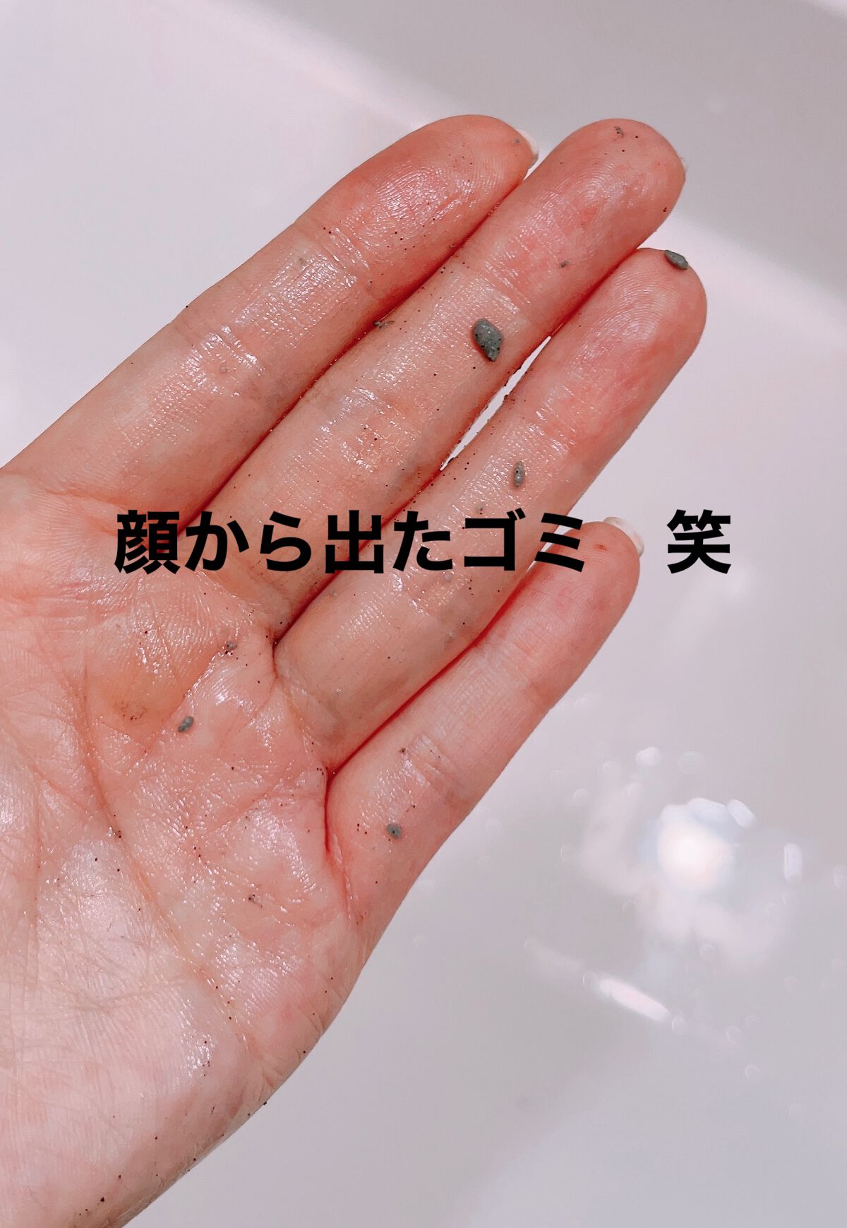 DETクリア ブライト&ピール ピーリングジェリー<炭タイプ>/Detclear/ピーリングを使ったクチコミ(4枚目)