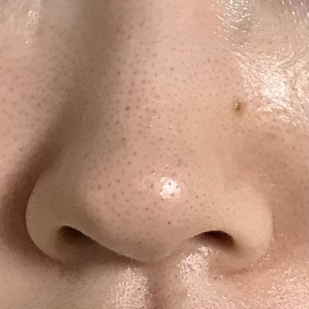 薬用 泡洗顔料/クレアラシル/洗顔フォームを使ったクチコミ（2枚目）