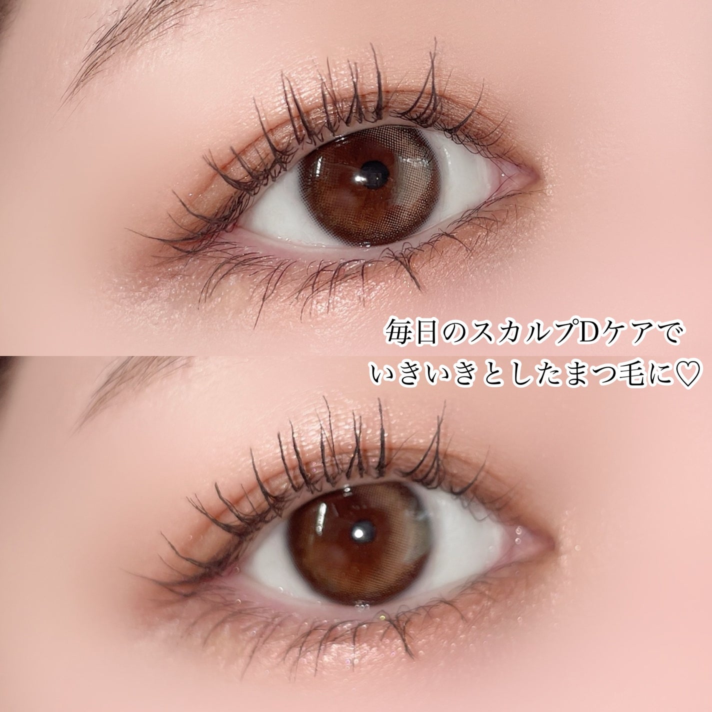 スカルプDまつ毛美容液 クイーン/アンファー(スカルプD)/まつげ美容液を使ったクチコミ(4枚目)