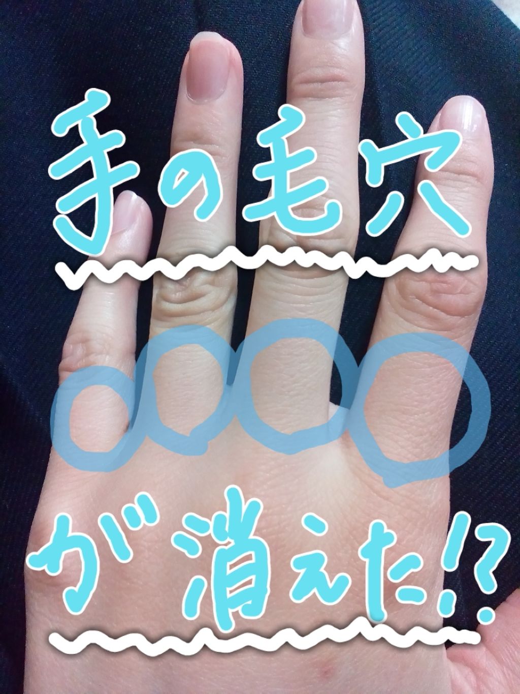 ニベアクリーム/ニベア/ボディクリームを使ったクチコミ（1枚目）