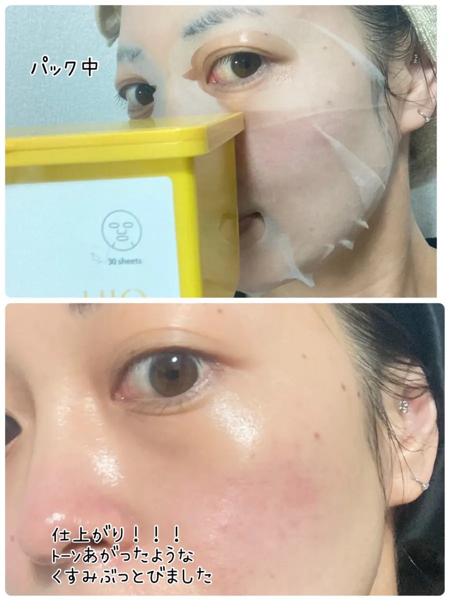 バイオームビタCグローデイリーシートマスク/UIQ/シートマスク・パックを使ったクチコミ（3枚目）