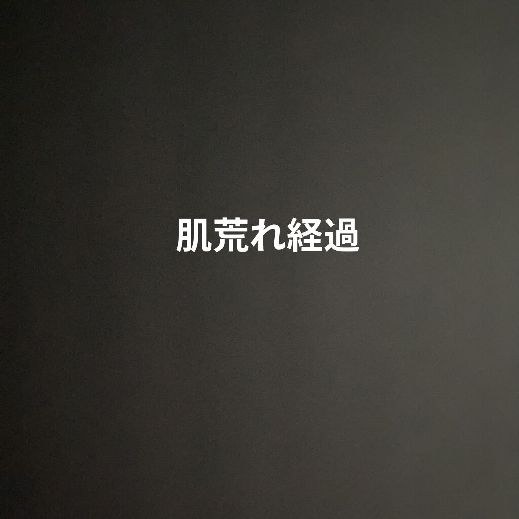 モイスチュア ローション/カルテHD/化粧水を使ったクチコミ（1枚目）