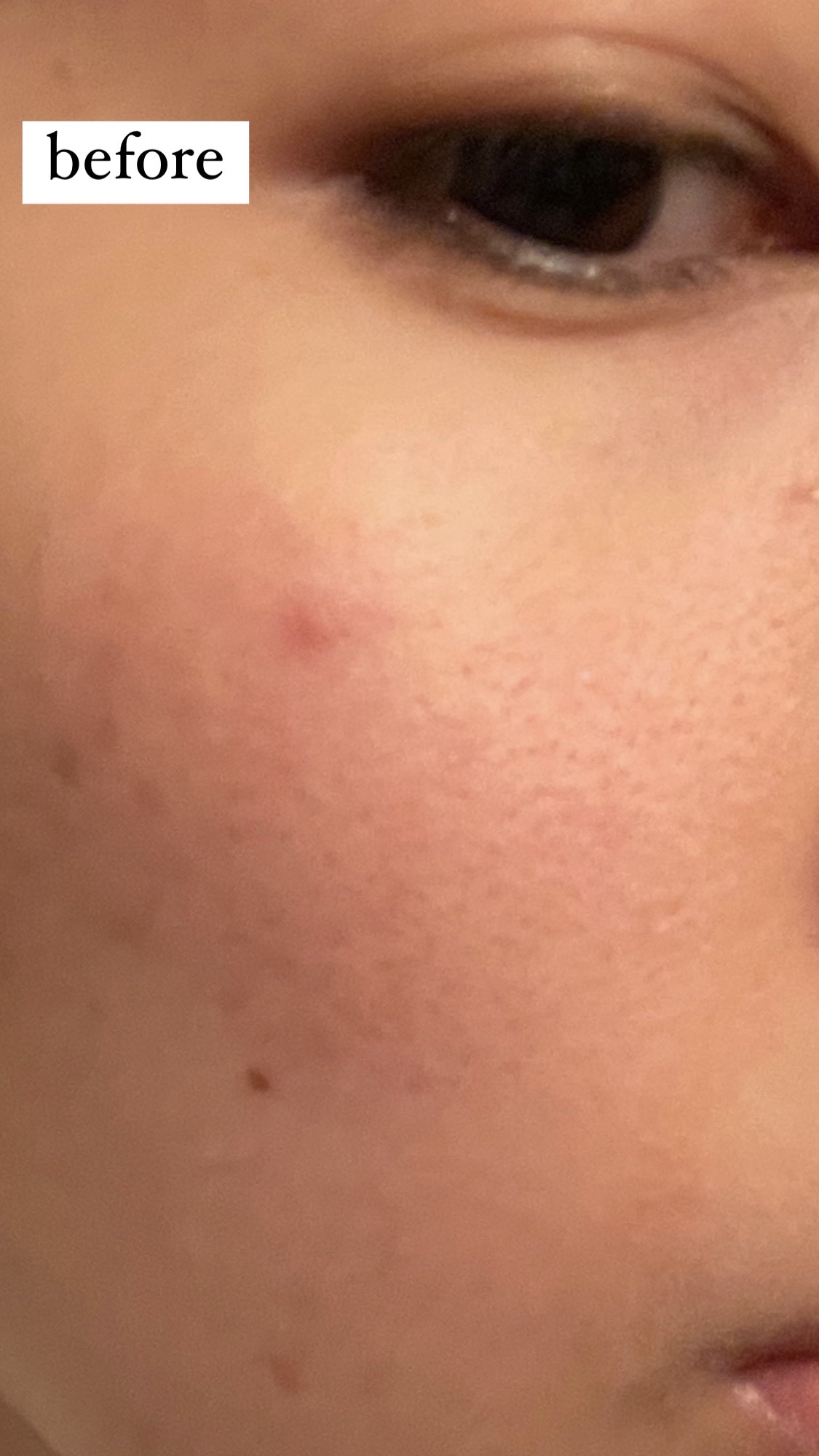 エリクシール ルフレ バランシング おやすみマスク/エリクシール/フェイスクリームを使ったクチコミ（2枚目）