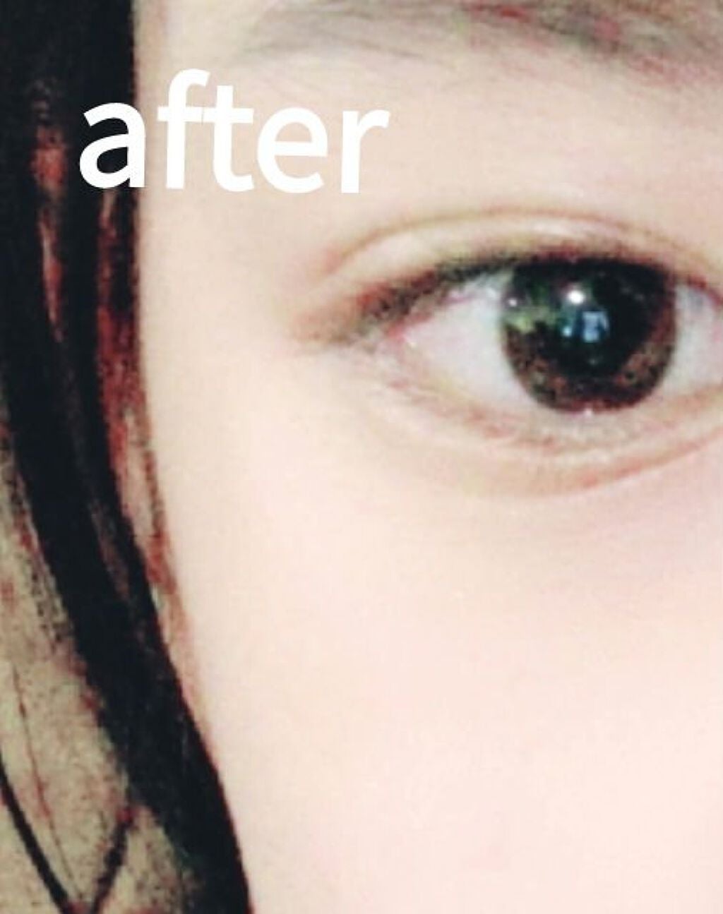 yuika_은어♡ on LIPS 「皆さん!ハトムギ化粧水とNIVEAパックを1週間したら、こんな..」(3枚目)