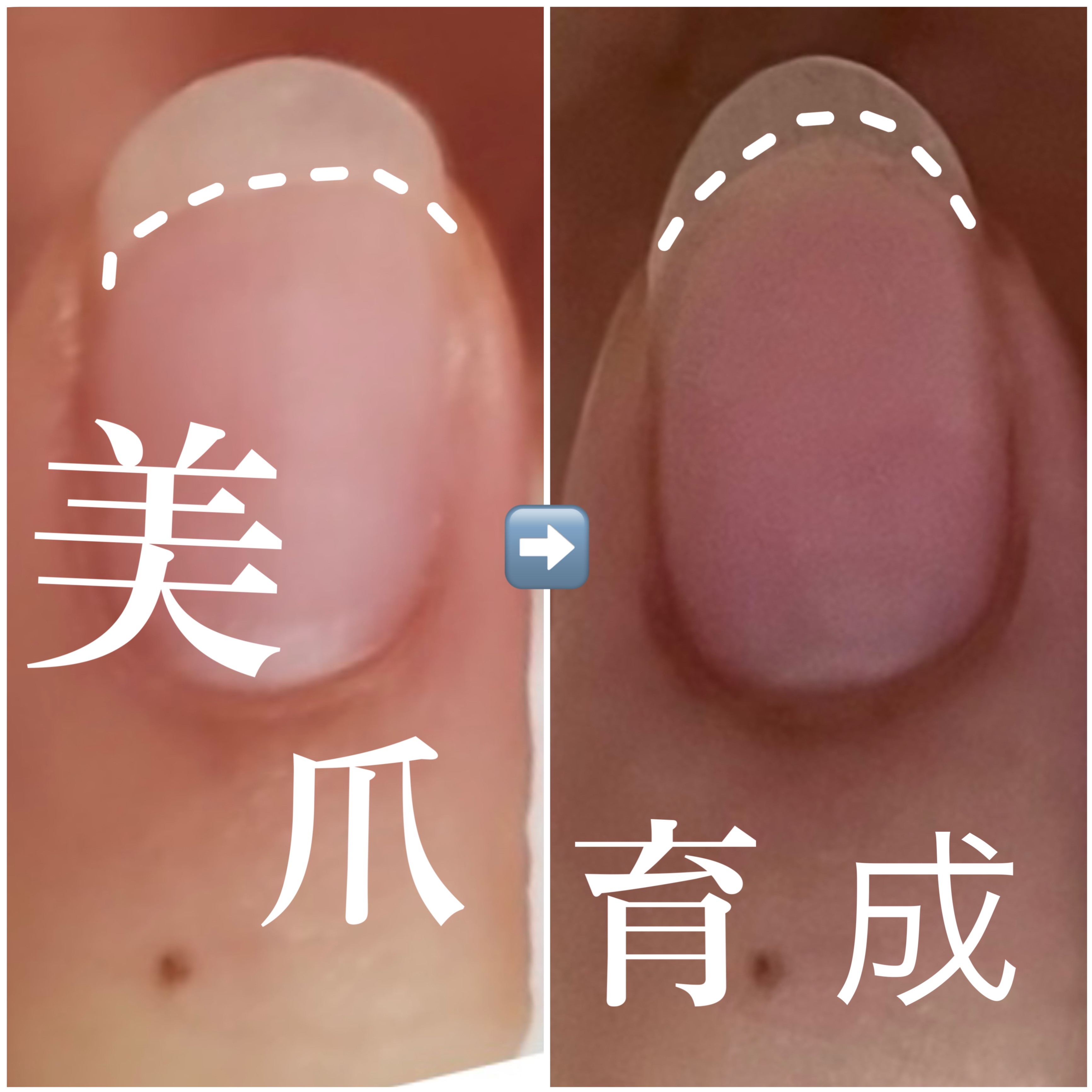 Mimits モイストネイルオイル Mimits モイストネイルオイル　レモン/ビー・エヌ/ネイルオイル・トリートメントを使ったクチコミ（1枚目）