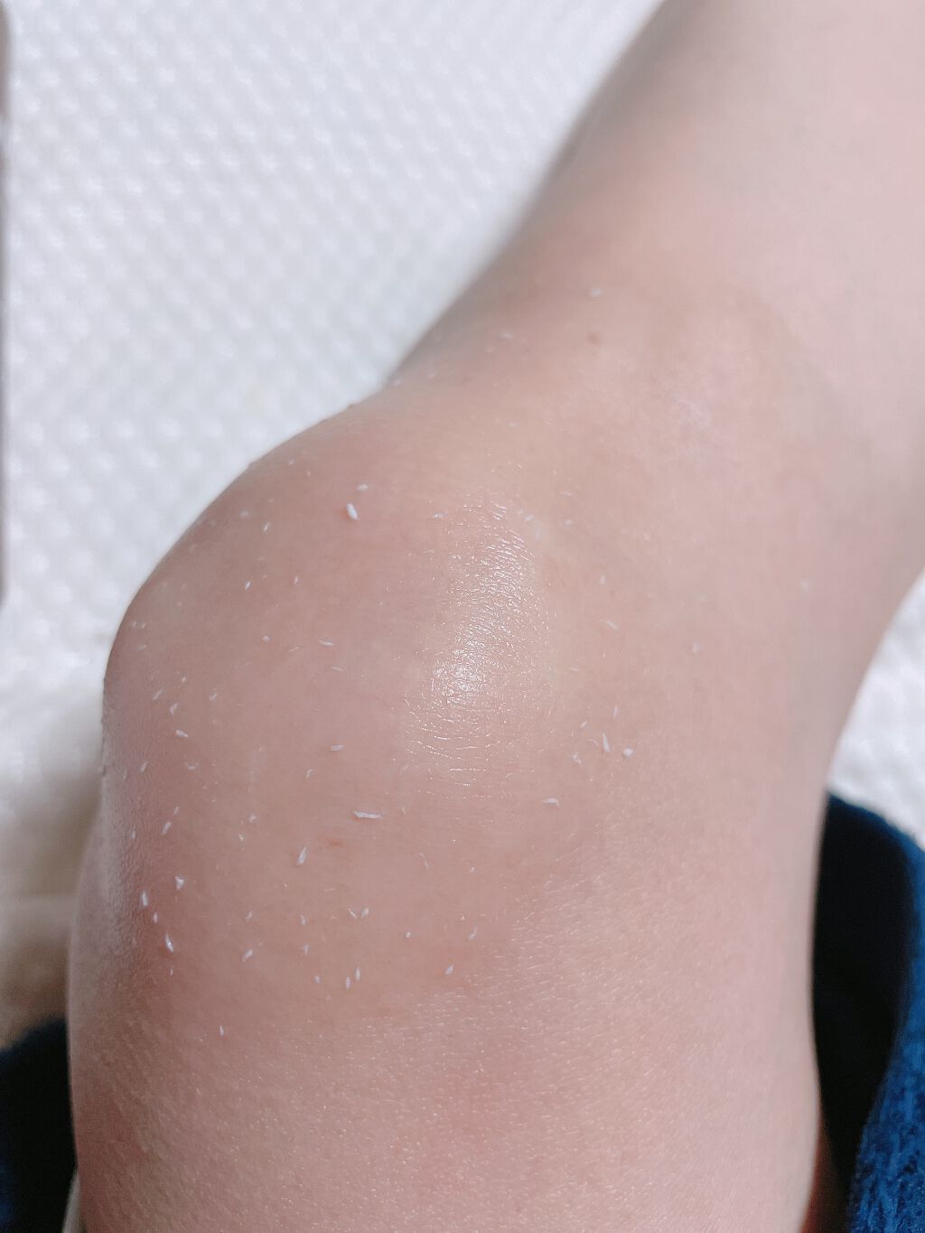 全身角質クリアゲル/NONON(ノンノン)/ピーリングを使ったクチコミ（3枚目）