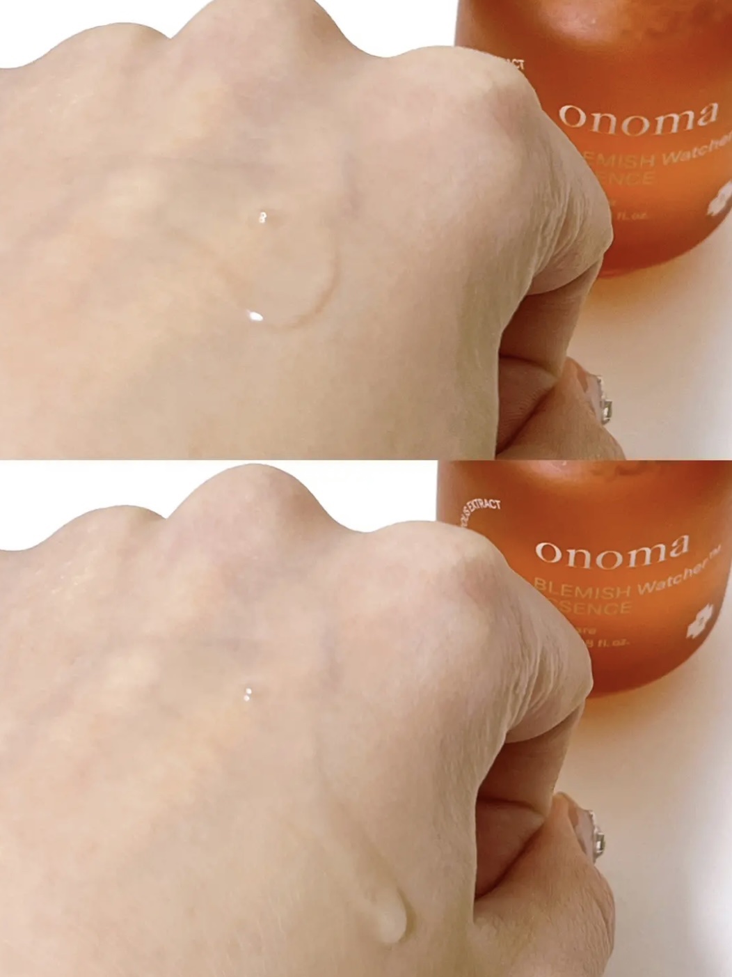ブレミッシュウォッチャーエッセンス/onoma/美容液を使ったクチコミ（3枚目）