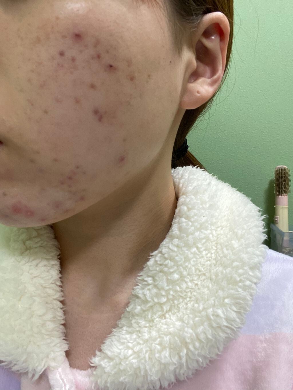 モイスチャー リッチローション(とてもしっとり)/アルージェ/化粧水を使ったクチコミ(4枚目)