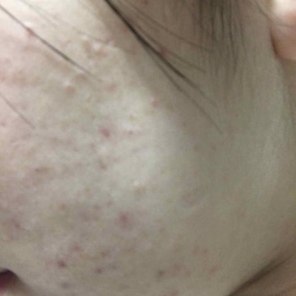 まっぷち on LIPS 「綺麗なってきた?????なってきたかな、根気強く頑張る!!..」(1枚目)