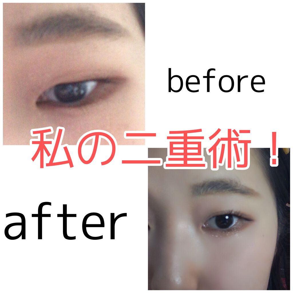 アイビューティー フィクサー WP/アストレア ヴィルゴ/二重まぶた用アイテムを使ったクチコミ(1枚目)