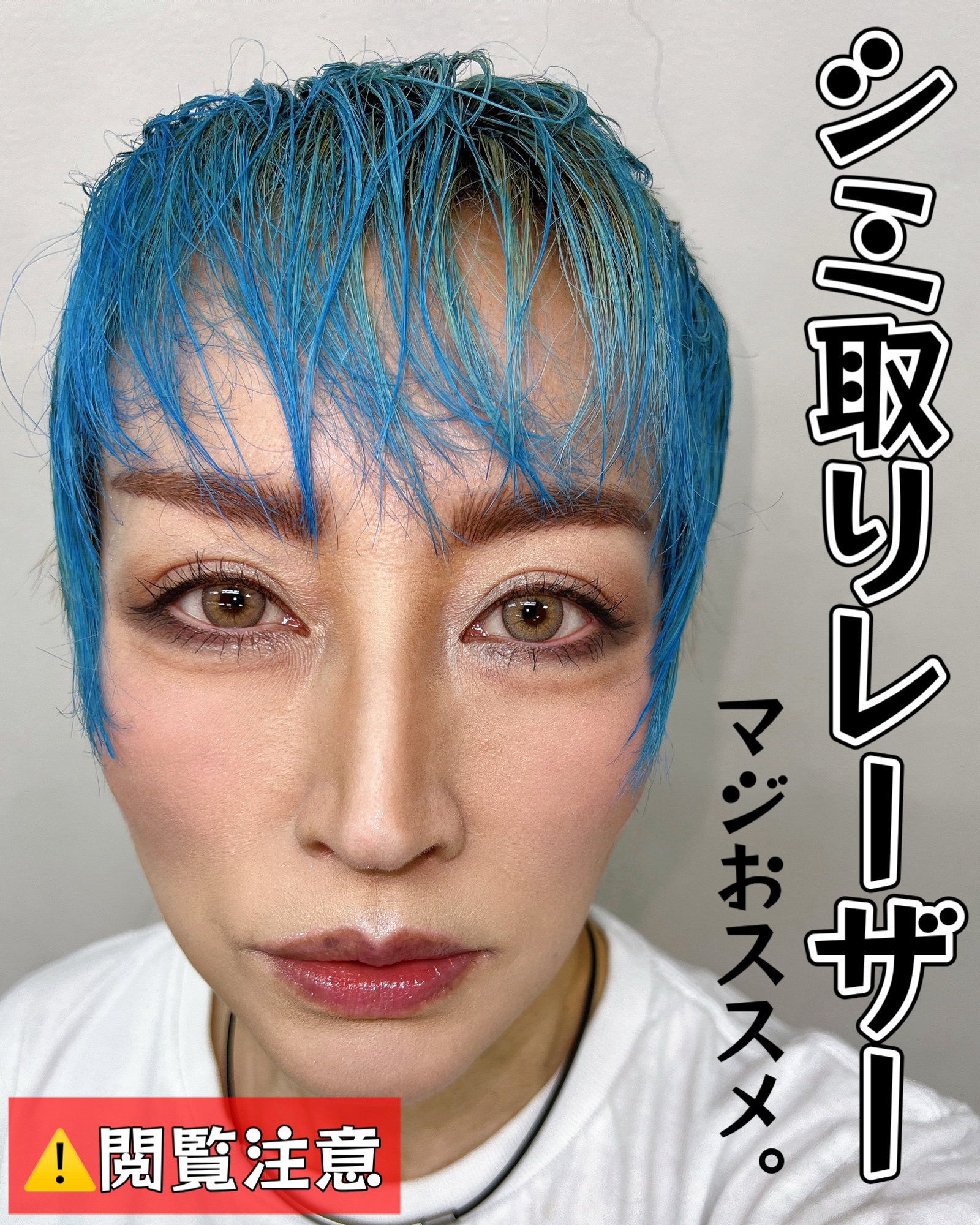 トラネキサム酸　250mg/東和薬品/その他を使ったクチコミ（1枚目）