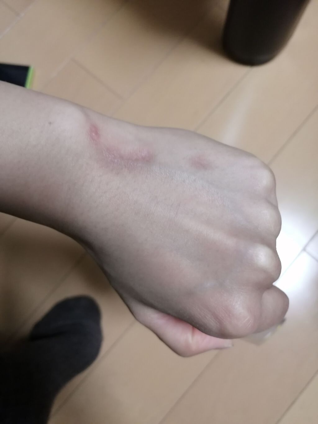 薬用 しみ 集中対策 美容液/メラノCC/美容液を使ったクチコミ（1枚目）