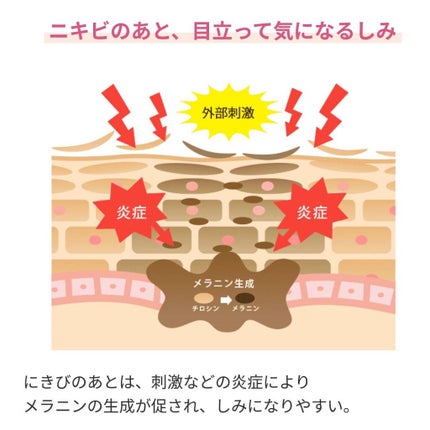 ニキビあとケアジェル/アットノン/その他スキンケアを使ったクチコミ(2枚目)