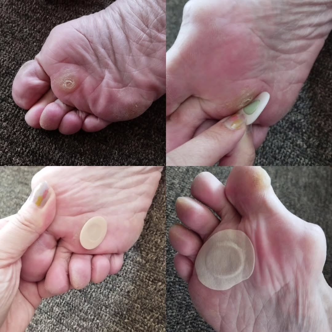 Totoronpan on LIPS 「スピール膏ワンタッチEX 足うらMサイズ/Lサイズ 使ってみた..」(3枚目)