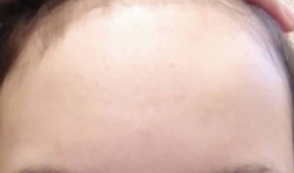 ハトムギ化粧水(ナチュリエ スキンコンディショナー R )/ナチュリエ/化粧水を使ったクチコミ（2枚目）