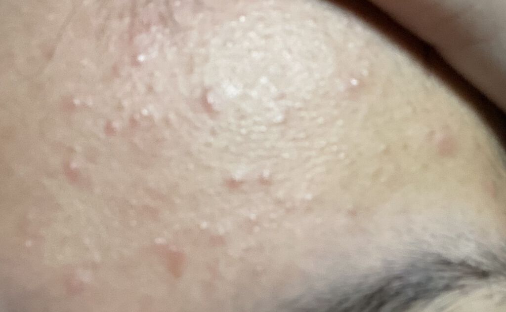 明色美顔水 薬用化粧水/美顔/化粧水を使ったクチコミ（3枚目）