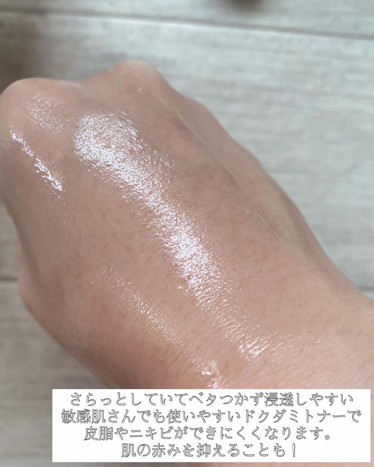 ドクダミ 77 スージングトナー/Anua/化粧水を使ったクチコミ(2枚目)