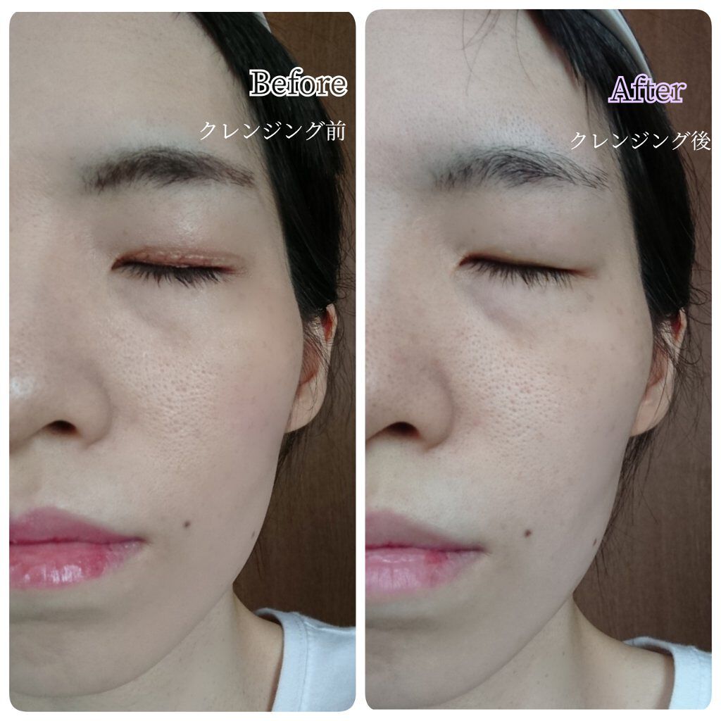 デュオ ザ クレンジングバーム ブラックリペア /DUO/クレンジングバームを使ったクチコミ(9枚目)