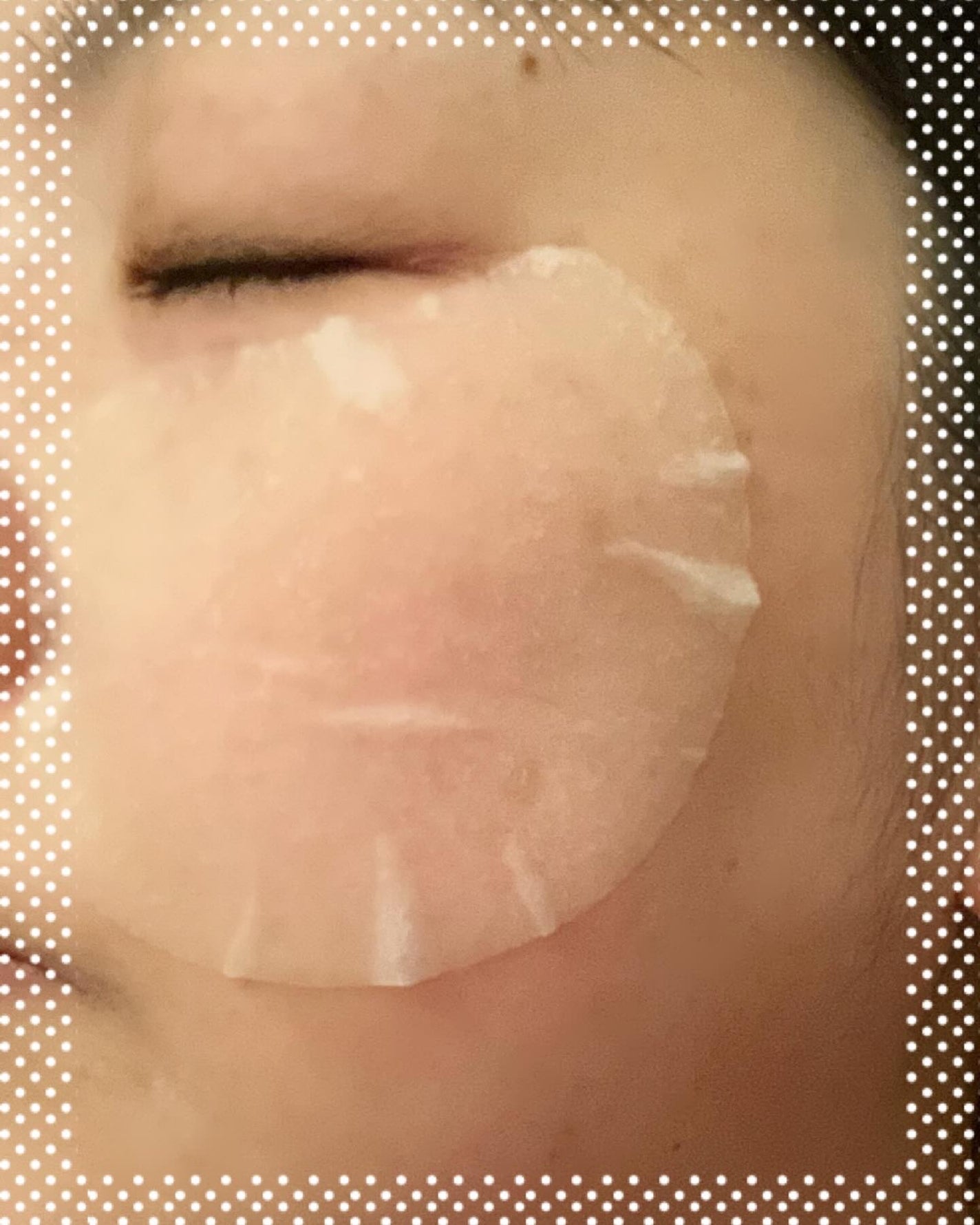 センテラ クイックカーミングパッド/SKIN1004/トナーパッドを使ったクチコミ(4枚目)