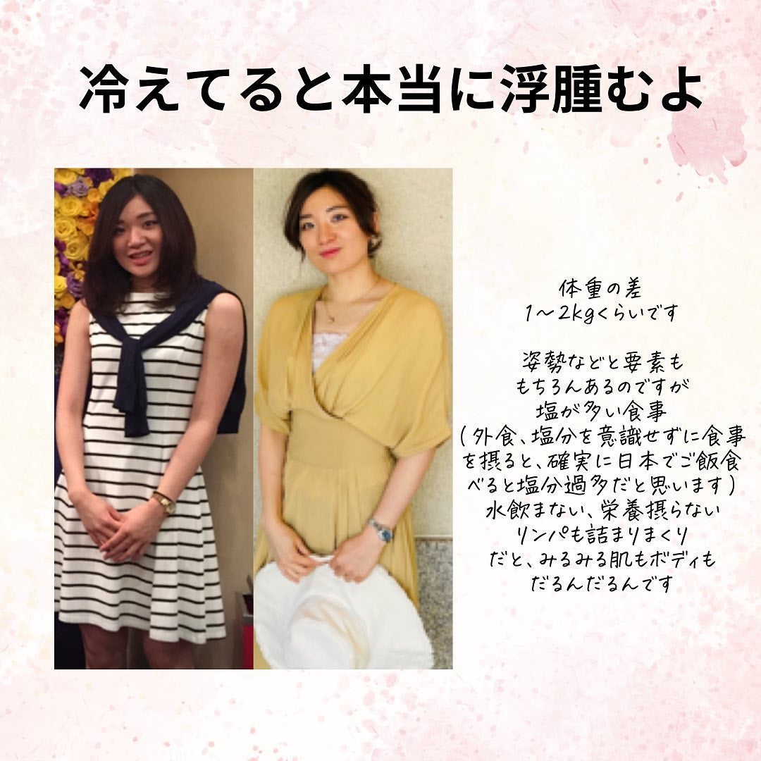 おゆみ|ニキビ・ニキビ跡ケア on LIPS 「@______ohyoume他の投稿はこちら💁♀️【最高の美..」(7枚目)