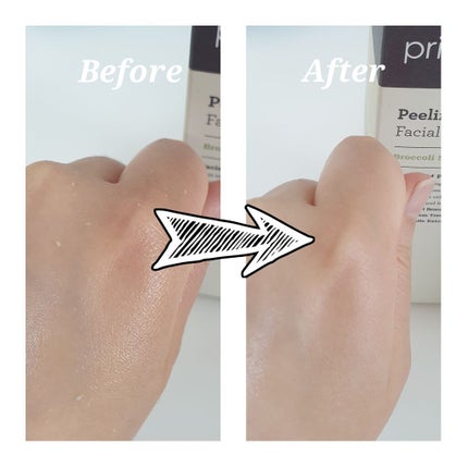 フェイシャルマイルドピーリング/primera/ピーリングを使ったクチコミ(2枚目)
