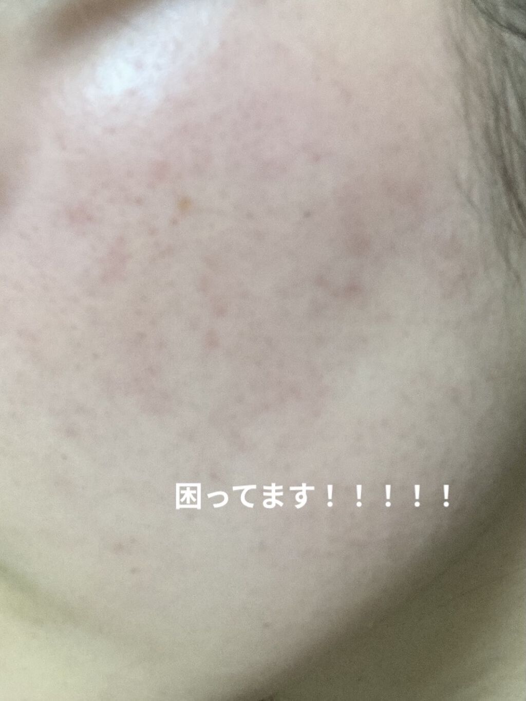 AHA·BHA·PHA 30デイズミラクルトナー/SOME BY MI/化粧水を使ったクチコミ（1枚目）