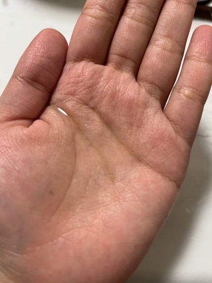 髪ã®ãã¡çŸå®¹ãã¬ãã¢ã ãã¢ãªã€ã«/ãšãã»ã³ã·ã£ã«/ãã¢ãªã€ã«ã䜿ã£ãã¯ãã³ãïŒ3æç®ïŒ