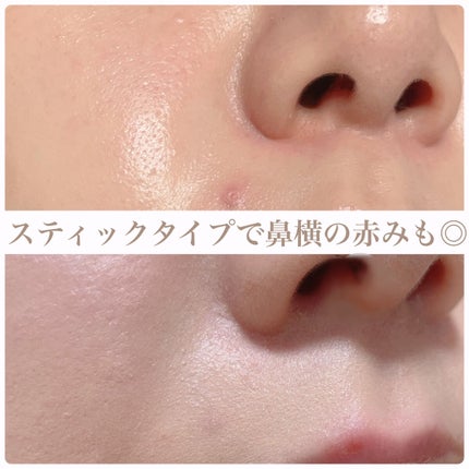 マスクフィットオールカバーデュアルコンシーラー/TIRTIR(ティルティル)/コンシーラーを使ったクチコミ(6枚目)