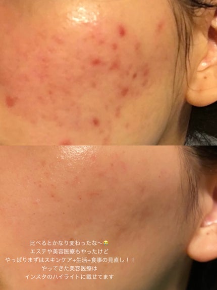 yuyuð¶èèãäœè³ªã®æ£çŽã¬ãã¥ãŒ on LIPS ããèãå€ããããã«ãã£ãããšä»ããããŒããªçŸå®¹æ
å ±ãæº¢ããããŠ..ãïŒ6æç®ïŒ