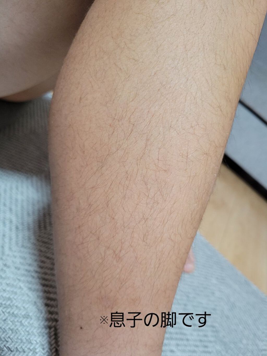 薬用Zリムーバー/コスメ二スト/除毛クリームを使ったクチコミ（2枚目）