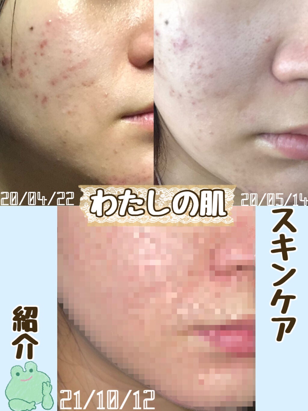 ビタライトビームエッセンシャルマスクEX/MEDIHEAL/シートマスク・パックを使ったクチコミ(1枚目)