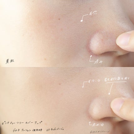 ピンクティーツリーカバーアップグロウクッション/APLIN/クッションファンデーションを使ったクチコミ(4枚目)