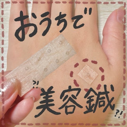 円皮鍼/ファロス/その他を使ったクチコミ(1枚目)