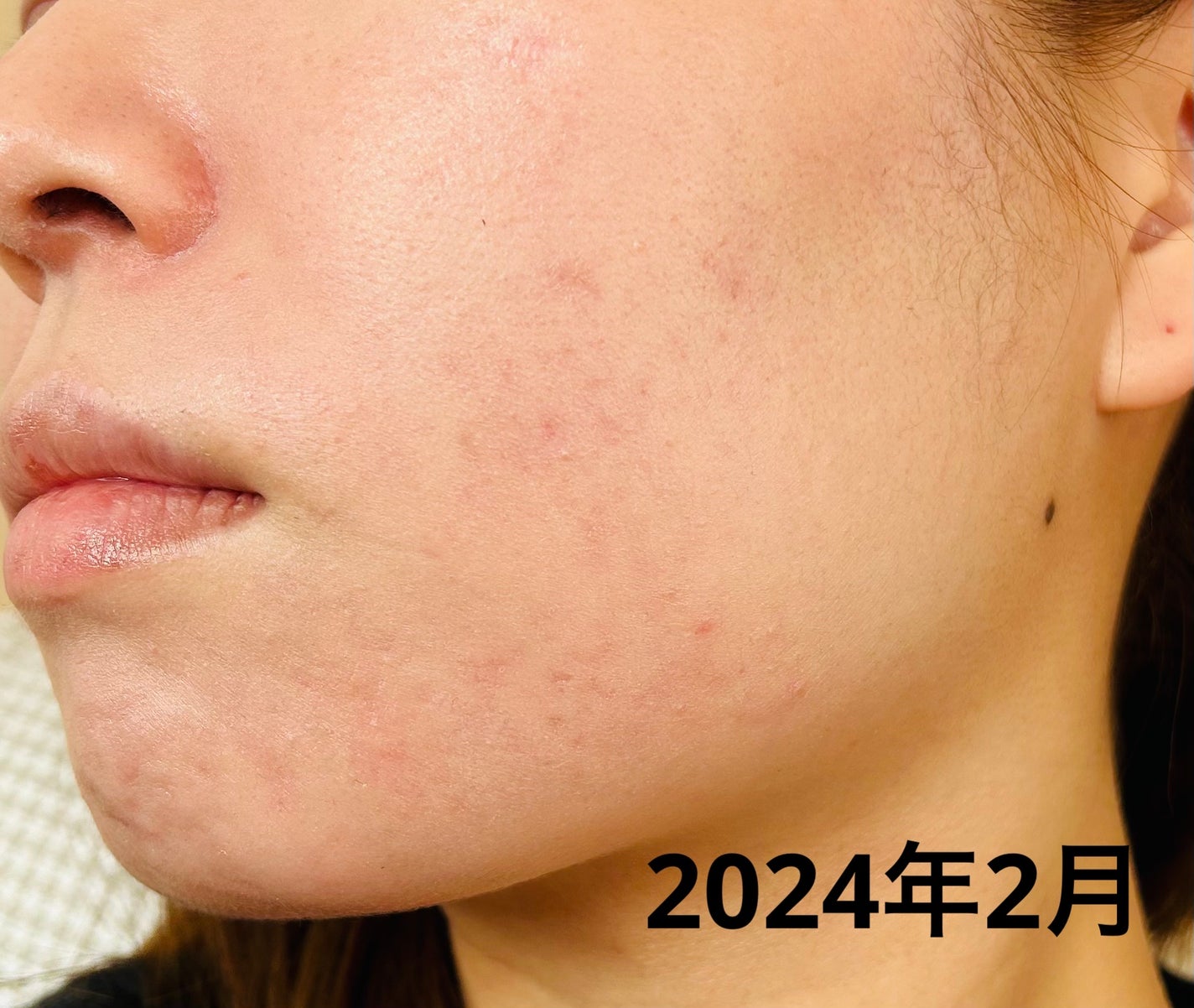 乾燥さん 薬用しっとり化粧液【医薬部外品】/乾燥さん/オールインワン化粧品を使ったクチコミ(2枚目)