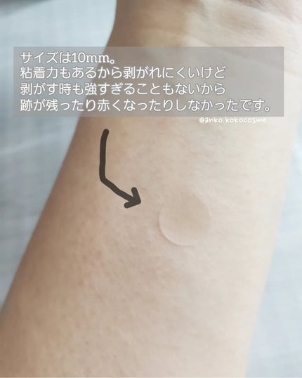 SPOT PATCH ロールタイプ/Shupong/にきびパッチを使ったクチコミ(5枚目)