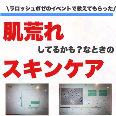 スキンケアのやり方を変えるだけで肌状態が良くなる！？

　
すっかり忘れていたシンプルステップの徹底。

肌状態が良くなってきていたから、ステップを増やしてもいいだろうという頭になっていました。

でも