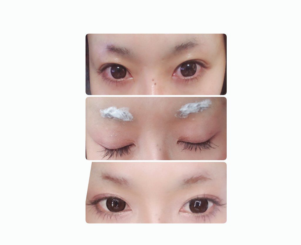 脱色クリーム スピーディー/エピラット/ムダ毛ケアを使ったクチコミ(2枚目)