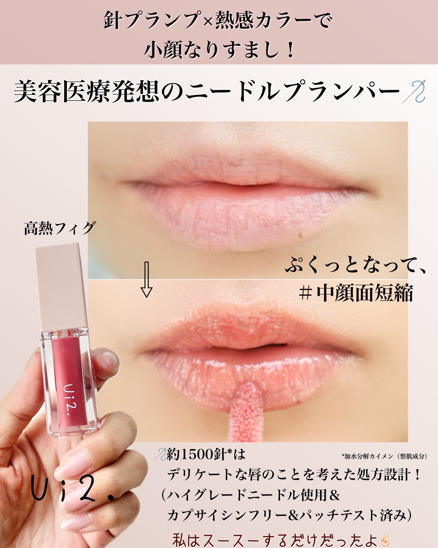 ニードルプランパー 高熱フィグ/Ui2./リッププランパーを使ったクチコミ（2枚目）