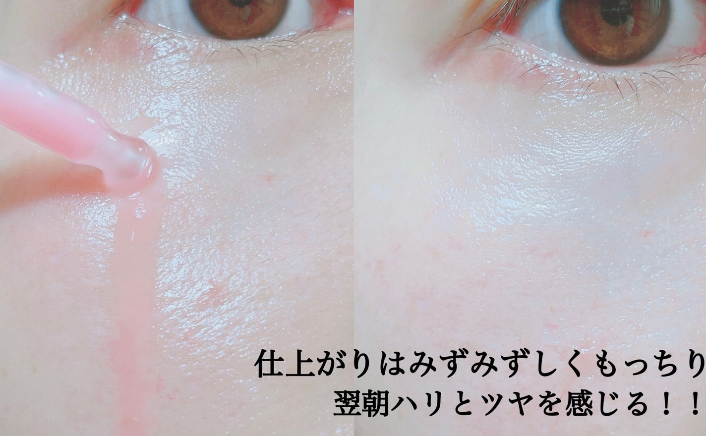 PDRNピンクアンプル PDRN 10,000ppm配合/MEDICUBE/美容液を使ったクチコミ(4枚目)