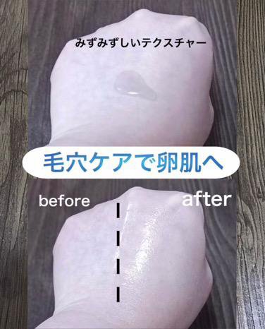 ゼロ毛穴1DAYセラム/MEDICUBE/美容液を使ったクチコミ（2枚目）
