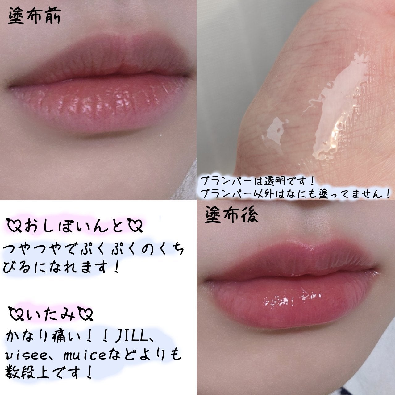 フィー 4Dボリューミングプランパー/fwee/リッププランパーを使ったクチコミ(3枚目)