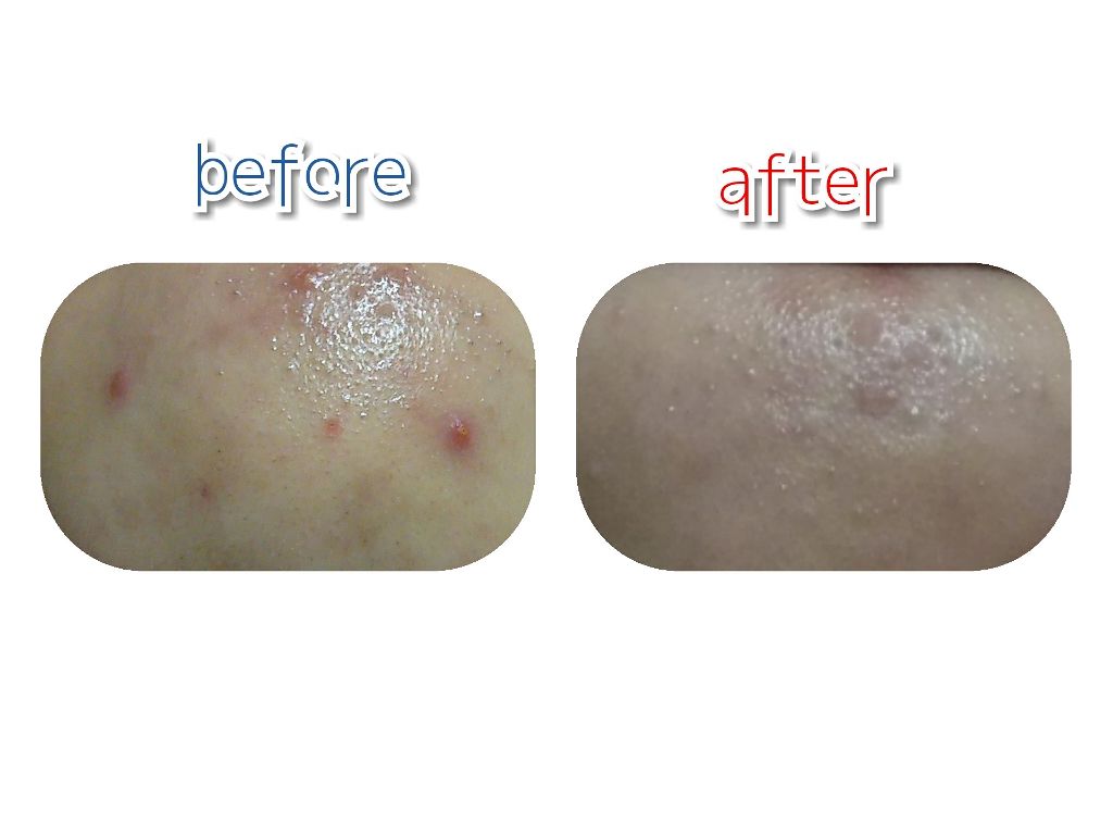 薬用洗顔フォーム/スキンライフ/洗顔フォームを使ったクチコミ（2枚目）