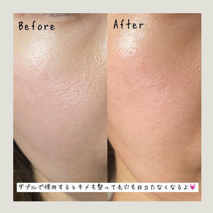 フルフィットプロポリスシナジートナー/COSRX/化粧水を使ったクチコミ(6枚目)