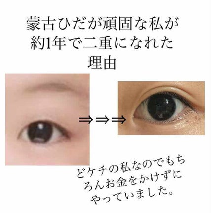 二重まぶた用シール/DAISO/二重まぶた用アイテムを使ったクチコミ(1枚目)