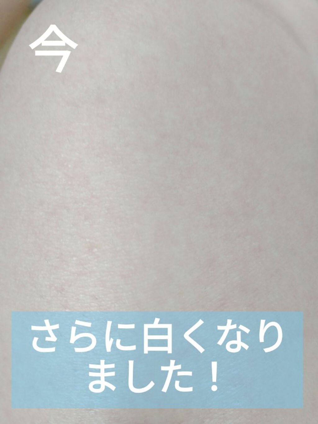 イントゥイション 敏感肌用 ホルダー (刃付き)+替刃1コ/イントゥイション/シェーバーを使ったクチコミ(3枚目)