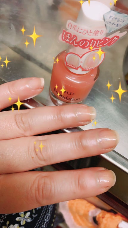 ディーアップファンデーション/D-UP/ネイルベースコートを使ったクチコミ(2枚目)