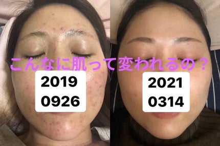 キールズ ハーバル トナー CL アルコールフリー/Kiehl's/化粧水を使ったクチコミ(1枚目)