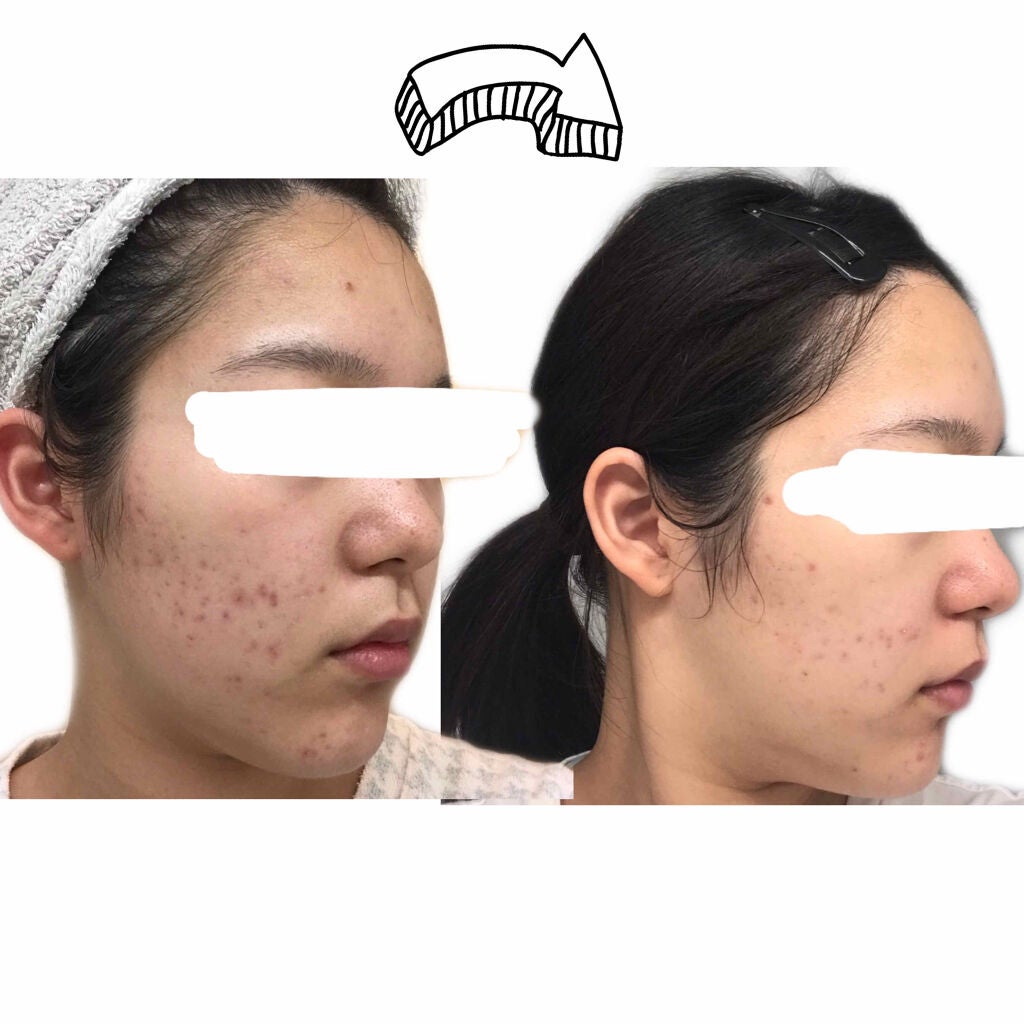 ホホバオイル/無印良品/ボディオイルを使ったクチコミ(3枚目)