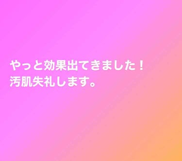 敏感肌用薬用美白美容液/無印良品/美容液を使ったクチコミ（1枚目）